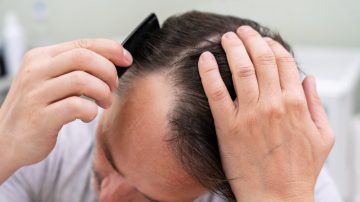 Queda de cabelo: causas comuns e como identificar