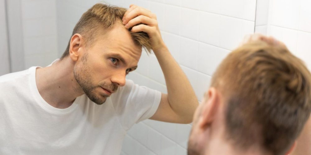 Por que a calvície afeta mais os homens?