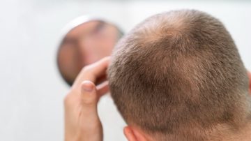 Estresse pode causar queda de cabelo? Descubra